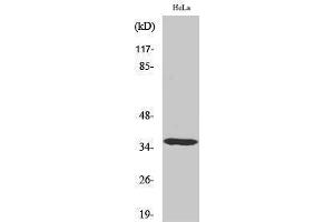 Western Blotting (WB) image for anti-Casein Kinase 1, alpha 1 (CSNK1A1) (Internal Region) antibody (ABIN3183657) (CSNK1A1 antibody  (Internal Region))