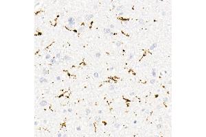 Immunohistochemistry of paraffin-embedded human brain using CD68 antibody (ABIN7266211) at dilution of 1:50 (40x lens).