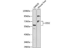Western blot analysis of extracts of various cell lines, using CES2 antibody (ABIN3022047, ABIN3022048, ABIN3022049 and ABIN6218583) at 1:1000 dilution. (CES2 antibody  (AA 310-410))
