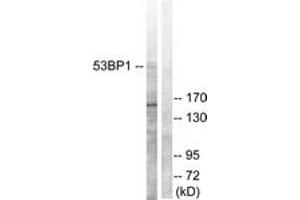 Western blot analysis of extracts from A549 cells, using 53BP1 (Ab-6) Antibody. (TP53BP1 antibody  (AA 1-50))