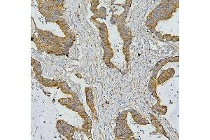 IHC analysis of AIF using anti-AIF antibody (ABIN6719266).