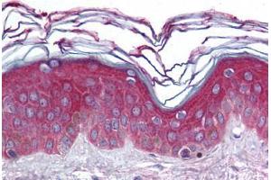 Human Skin (formalin-fixed, paraffin-embedded) stained with ARHGEF11 antibody ABIN296726 at 10 ug/ml followed by biotinylated goat anti-rabbit IgG secondary antibody ABIN481713, alkaline phosphatase-streptavidin and chromogen. (ARHGEF11 antibody  (AA 1-50))
