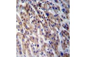 Formalin fixed and paraffin embedded human liver tissue stained with CPN1 Antibody (Center) followed by peroxidase conjugation of the secondary antibody and DAB staining. (CPN1 antibody  (Middle Region))