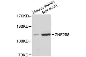 Western blot analysis of extracts of various cell lines, using ZNF268 antibody. (ZNF268 antibody)