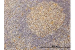 Immunoperoxidase of monoclonal antibody to SURB7 on formalin-fixed paraffin-embedded human tonsil. (MED21 antibody  (AA 1-144))