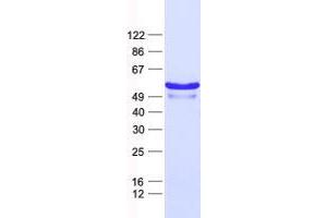 Validation with Western Blot (ZNF200 Protein (His tag))