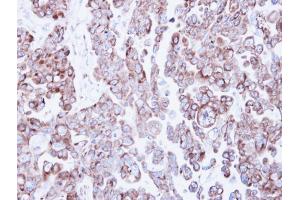 IHC-P Image Immunohistochemical analysis of paraffin-embedded OVCAR3 xenograft, using Ribosome binding protein 1, antibody at 1:500 dilution. (RRBP1 antibody  (C-Term))