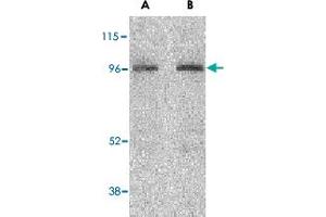 Western blot analysis of NOD2 in HeLa cell lysate with NOD2 polyclonal antibody  at (A) 2 and (B) 4 ug/mL . (NOD2 antibody  (C-Term))
