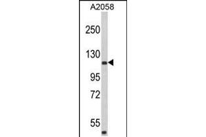 Western blot analysis of HMHA1 Antibody in A2058 cell line lysates (35ug/lane) (HMHA1 antibody  (AA 877-903))