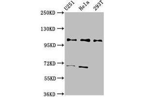 Western Blot Positive WB detected in: U251 whole cell lysate, Hela whole cell lysate, 293T whole cell lysate All lanes: PRPF40A antibody at 2. (PRPF4 antibody  (AA 120-266))