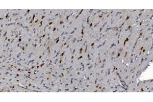 IHC analysis of Alpha B Crystallin/CRYAB using anti-Alpha B Crystallin/CRYAB antibody (ABIN7601209). (CRYAB antibody  (AA 30-151))