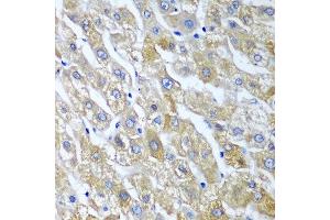 Immunohistochemistry of paraffin-embedded human liver using SGSH antibody at dilution of 1:100 (40x lens). (SGSH antibody)