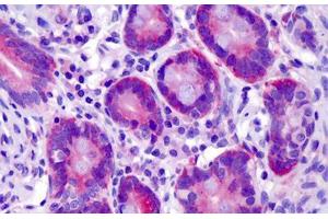 Human Small Intestine: Formalin-Fixed, Paraffin-Embedded (FFPE) (ST14 antibody  (AA 10-59))