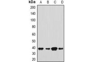 Western blot analysis of SH3GL2 expression in Hela (A), HepG2 (B), mouse brain (C), mouse testis (D) whole cell lysates. (SH3G2 antibody)