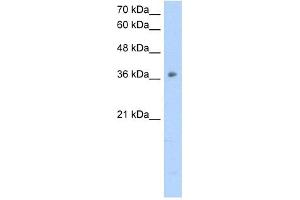 OTC antibody used at 2. (OTC antibody  (N-Term))