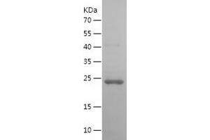 Western Blotting (WB) image for Oncostatin M (OSM) (AA 26-221) protein (His tag) (ABIN7283318) (Oncostatin M Protein (OSM) (AA 26-221) (His tag))