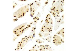 Immunohistochemistry (IHC) image for anti-ELAV (Embryonic Lethal, Abnormal Vision, Drosophila)-Like 1 (Hu Antigen R) (ELAVL1) (AA 1-326) antibody (ABIN3022231)