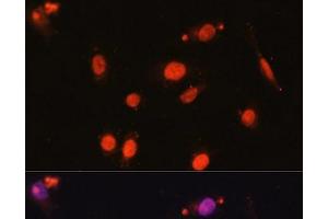 Immunofluorescence analysis of U2OS cells using DDX17 Polyclonal Antibody at dilution of 1:100. (DDX17 antibody)