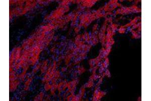 Immunofluorescence (IF) image for anti-Epithelial Cell Adhesion Molecule (EPCAM) antibody (Alexa Fluor 594) (ABIN2656829) (EpCAM antibody  (Alexa Fluor 594))