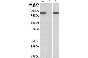 HEK293 lysate (10ug protein in RIPA buffer) overexpressing Human STAT4 (RC206892) with C-terminal MYC tag probed with ABIN571128 (1ug/ml) in Lane A and probed with anti-MYC Tag (1/1000) in lane C. (STAT4 antibody  (AA 369-383))