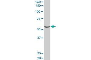 FLI1 monoclonal antibody (M03), clone 2A2. (FLI1 antibody  (AA 1-452))