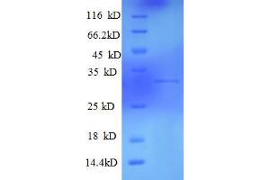 SDS-PAGE (SDS) image for Killer Cell Lectin-Like Receptor Subfamily G, Member 1 (KLRG1) (AA 60-195), (Extracellular) protein (His-SUMO Tag) (ABIN5711642)