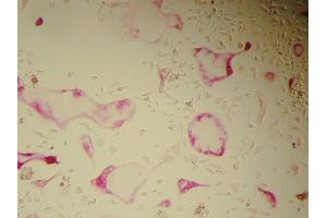 Immunohistochemistry (IHC) image for Osteoclast (Rat) Culture Kit (ABIN956046) (Osteoclast (Rat) Culture Kit)