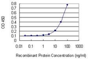 Detection limit for recombinant GST tagged FBXL19 is 3 ng/ml as a capture antibody. (FBXL19 antibody  (AA 365-472))