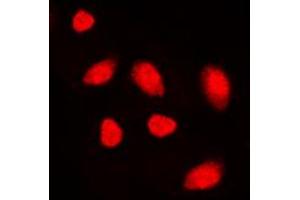Immunofluorescent analysis of MUTYH staining in K562 cells. (MUTYH antibody  (Center))