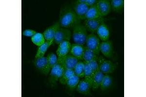 IF analysis of PPFIA1 using anti-PPFIA1 antibody (ABIN7600454). (PPFIA1 antibody  (AA 198-1202))