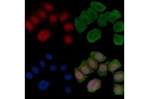 ABIN6255742 and ABIN6266454 staining Hela cells(45 min of heat-shock treatment) by IF/ICC. (Retinoblastoma Protein (Rb) antibody  (pThr826))