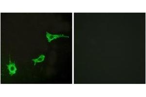 Immunofluorescence analysis of LOVO cells, using EDNRA Antibody. (Endothelin-1 Receptor antibody  (AA 378-427))
