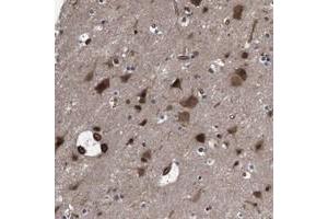 Immunohistochemical staining of human cerebral cortex with PAWR polyclonal antibody  shows strong cytoplasmic and nuclear positivity in neuronal cells and glial cells at 1:50-1:200 dilution.