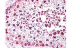 Anti-TSPY1 / TSPY antibody IHC staining of human testis. (TSPY1 antibody  (C-Term))