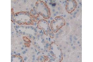 Figure. (SLC12A7 antibody  (AA 845-1056))