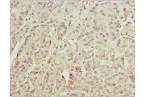 Immunohistochemistry of paraffin-embedded human pancreatic tissue using ABIN7176057 at dilution of 1:100 (ZFYVE1 antibody  (AA 1-280))