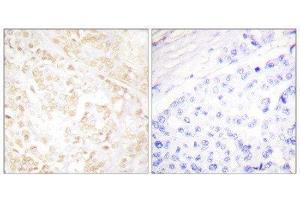 Immunohistochemistry (IHC) image for anti-X-Ray Repair Complementing Defective Repair in Chinese Hamster Cells 6 (XRCC6) (C-Term) antibody (ABIN1848904) (XRCC6 antibody  (C-Term))