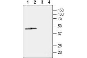 NIPA2 antibody  (2nd Extracellular Loop)