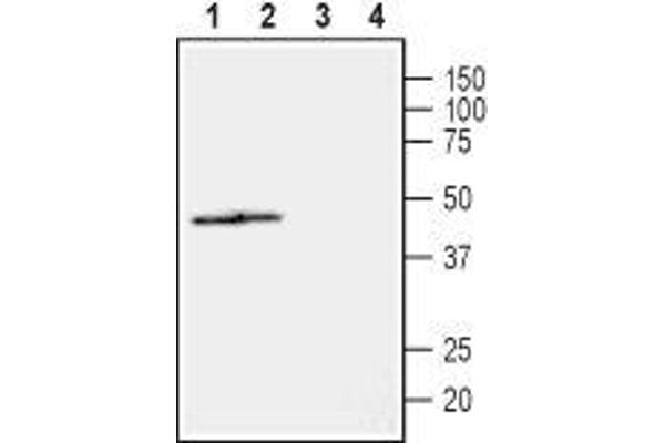 NIPA2 antibody  (2nd Extracellular Loop)