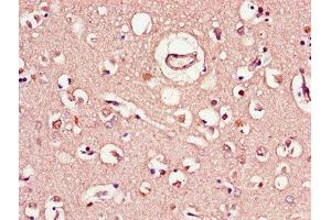Immunohistochemistry of paraffin-embedded human brain tissue using ABIN7148328 at dilution of 1:100