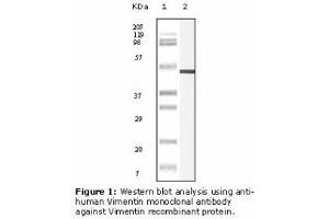 Image no. 2 for anti-Vimentin (VIM) antibody (ABIN232124) (Vimentin antibody)