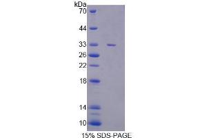 SDS-PAGE analysis of Mouse CASC5 Protein. (CASC5 Protein)