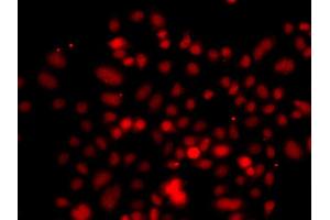 Immunofluorescence analysis of A549 cell using RRAGC antibody. (GTR2 antibody)