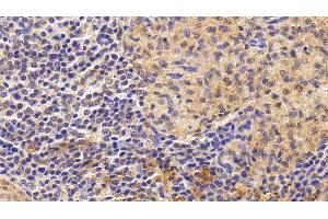 Detection of IL6 in Human Spleen Tissue using Monoclonal Antibody to Interleukin 6 (IL6) (IL-6 antibody  (AA 29-212))