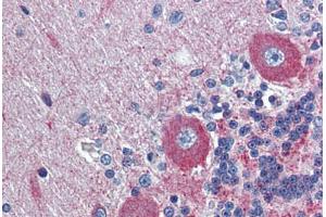 Human Brain, cerebellum: Formalin-Fixed, Paraffin-Embedded (FFPE) (GPR6 antibody  (N-Term))