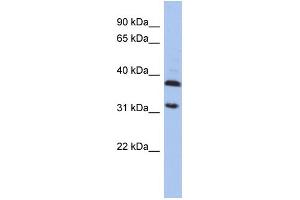 WB Suggested Anti-ASPA Antibody Titration: 0. (ASPA antibody  (Middle Region))