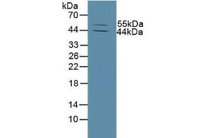 Figure. (MMP13 antibody  (AA 290-468))