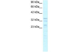ZNF385 antibody used at 0. (ZNF385A antibody  (C-Term))