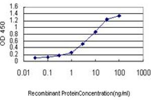 Detection limit for recombinant GST tagged IRAK3 is approximately 0. (IRAK3 antibody  (AA 497-596))