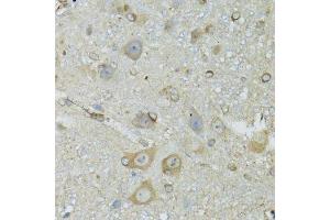 Immunohistochemistry of paraffin-embedded mouse brain using CRYM antibody. (CRYM antibody  (AA 1-314))